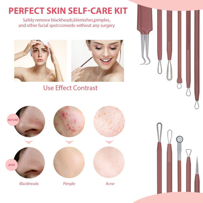 JPNK Blackhead Remover Tool Comedones Extractor Acne Removal Kit for Blemish, Whitehead Popping, 6 Pcs Zit Removing for Nose Face Tools with a Leather Bag (Pink)