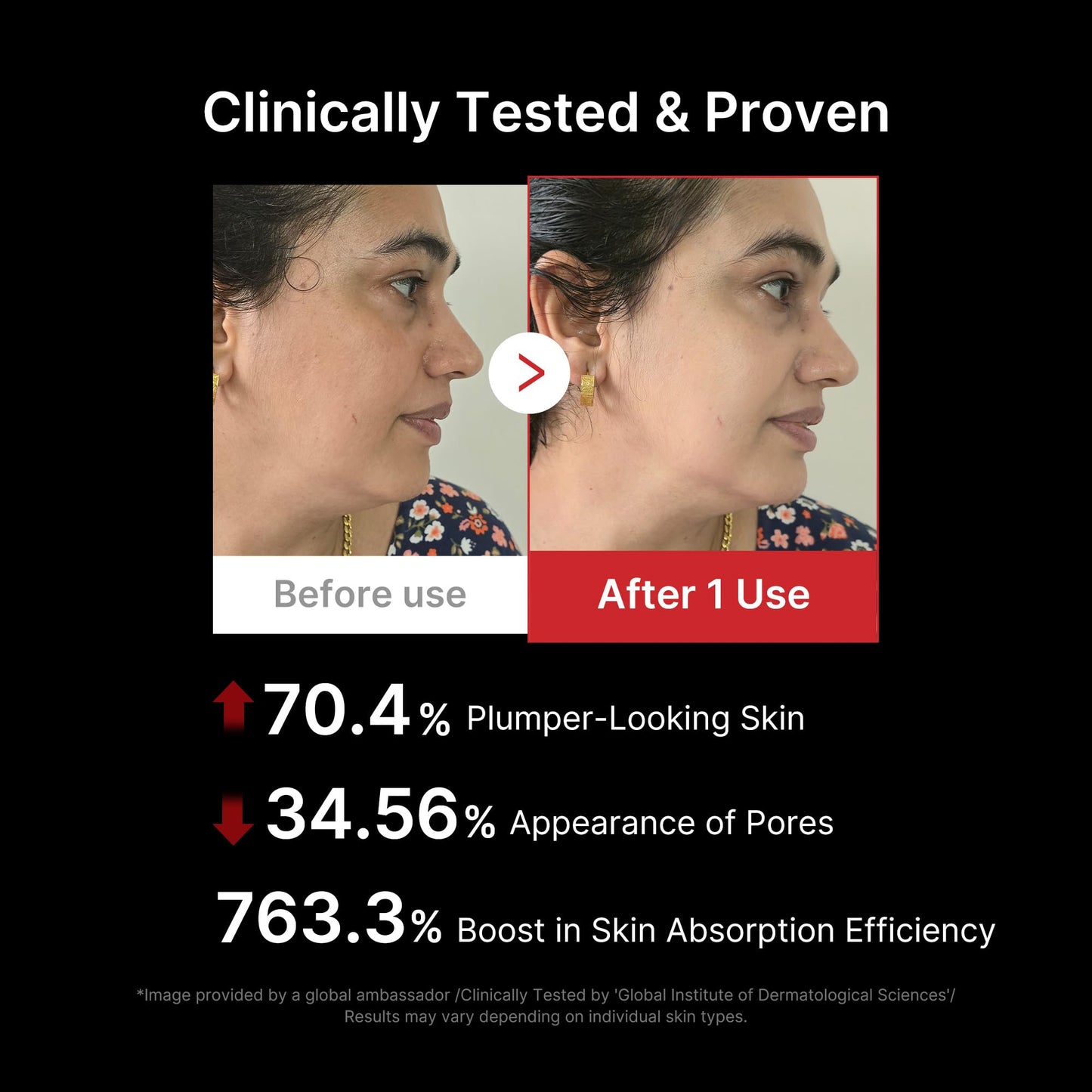 medicube Age-R Booster Pro Pink | 6-in-1 Real Glass Glow Beauty Massager | Looking Glass Skin | Korean Skin Care