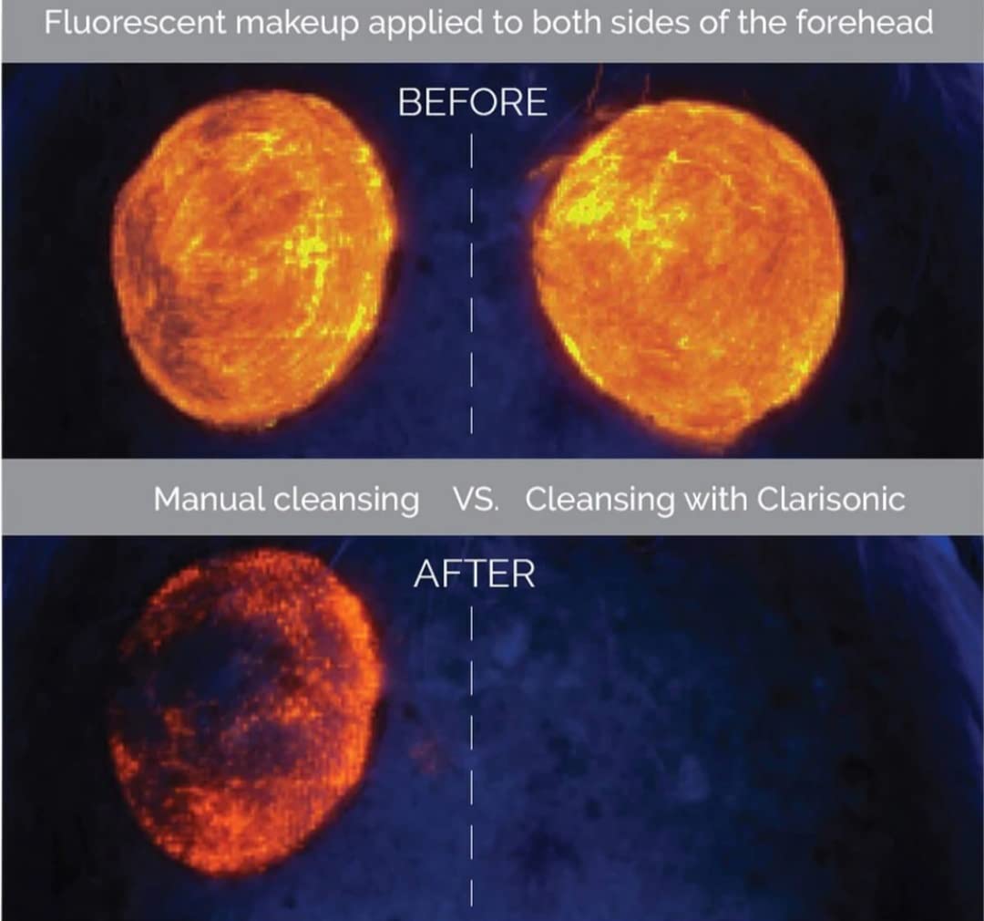 Clarisonic Mia Smart